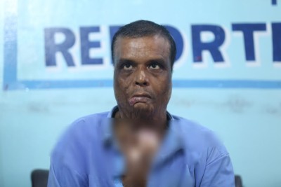 आलम घटनामा घाइते गौरीशंकरको प्रश्न ‘श्रीमान म जिउँदै छु, कसरी बम पड्किएको हैन भनेको ? ’