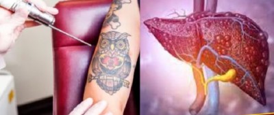 ट्याटुको क्रेज, रोगको खतरा: फेसनले निम्त्याउन सक्छ गम्भीर संक्रमण